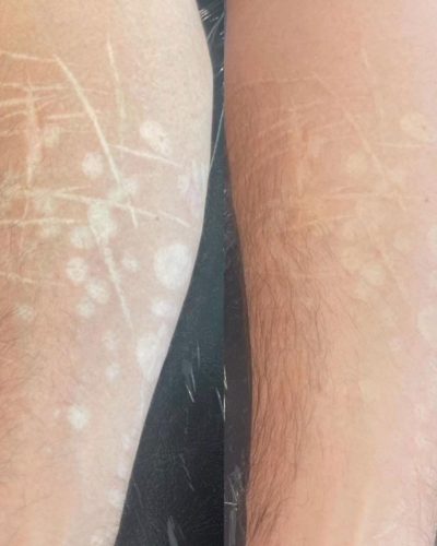 skin-1